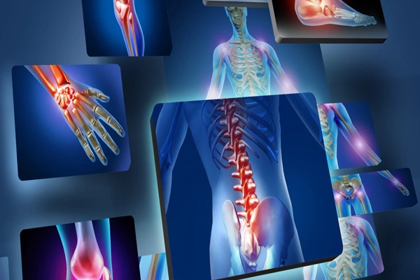 cách phòng bệnh xương khớp