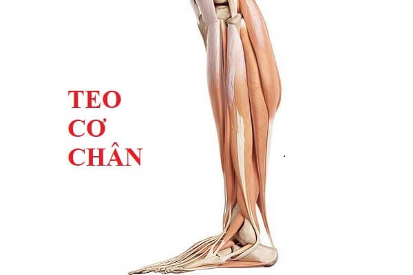 bệnh viêm xương khớp