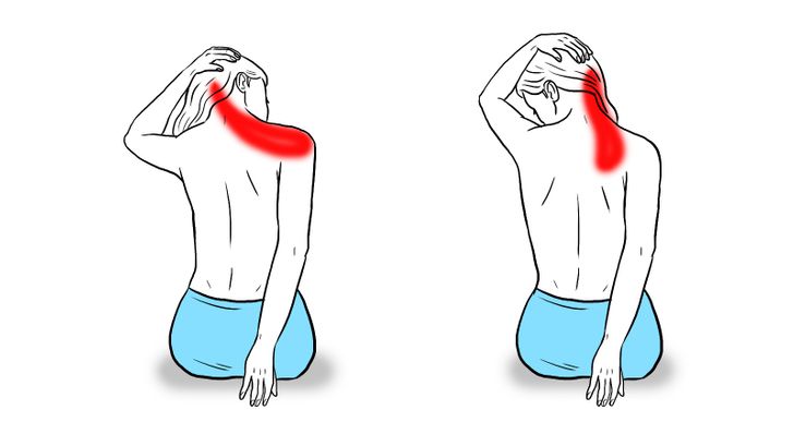 Bài tập duỗi cơ vai giảm đau cổ vai gáy