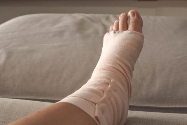 bao lâu thì khỏi bong gân mắt cá chân